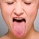 Dry tongue